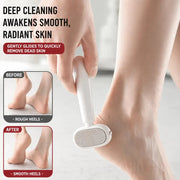 Dual-Sided Foot Callus Remover – Smooth. Soft Feet Without the Fuss