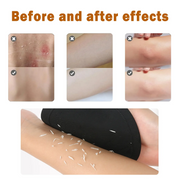 4-in-1 Exfoliating Scrubber Set | Reveal Silky Smooth Skin In Every Shower(4PCS)